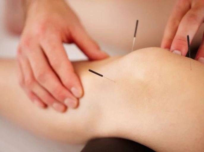 脚に鍼を打っている画像